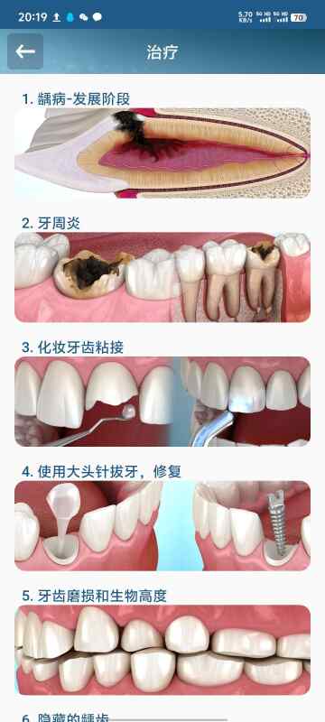 DentalIllus2.1.101🔥牙齿部位解剖🔥